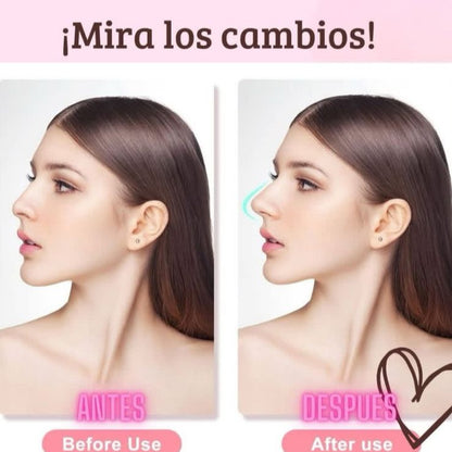 Respingador de Nariz